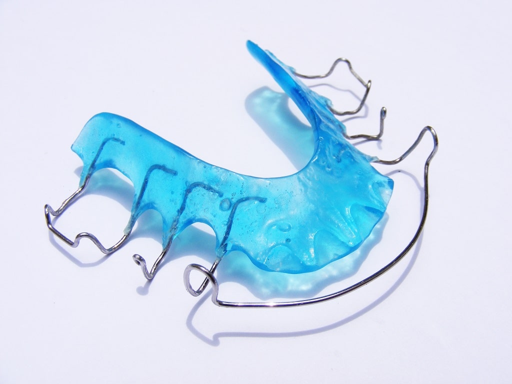 Aparelho De Conten o Fixa E M vel Entenda As Diferen as OrthoDontic
