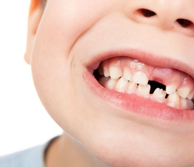 Dentes de leite